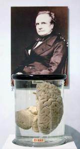 C Babbage brain